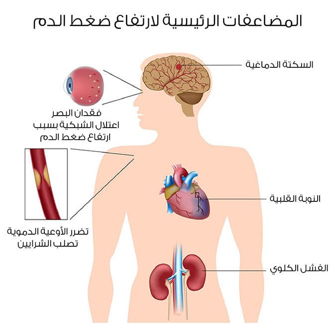 معلومات عن ضغط الدم , اشياء يجب ان تعرفها اذا كنت مريض ضغط