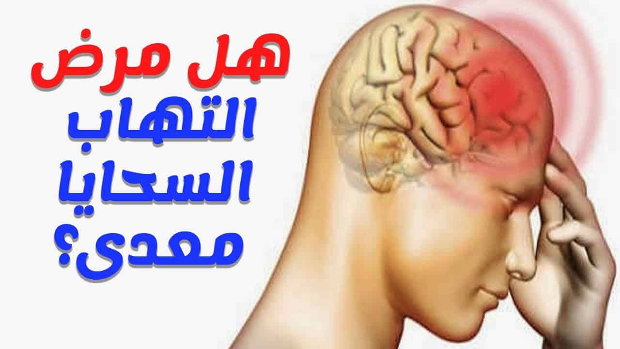 مرض السحايا , اغرب الامراض و طرق علاجها