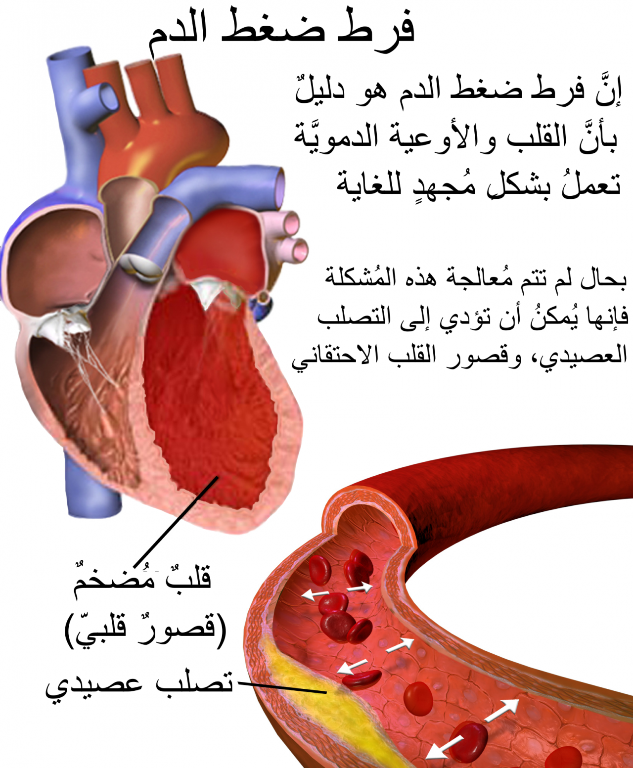 معنى ضغط الدم - معلومات هامة عن ضغط الدم 10973 4