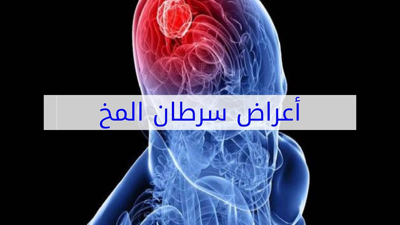 اعراض سرطان الدماغ - الاعراض المصاحبة لسرطان المخ 4546 2