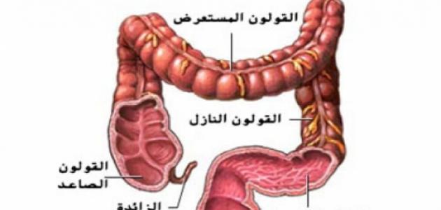 مرض القولون , ماهي الاسباب لمرض القاولون