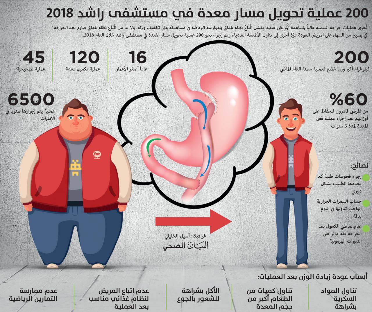 اسباب زيادة الوزن بعد التكميم- ماذا بعد تكميم المعدة 18019 2