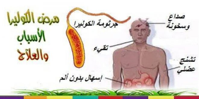 مرض الكوليرا - ماهى اعراض مرض الكوليرا 5388