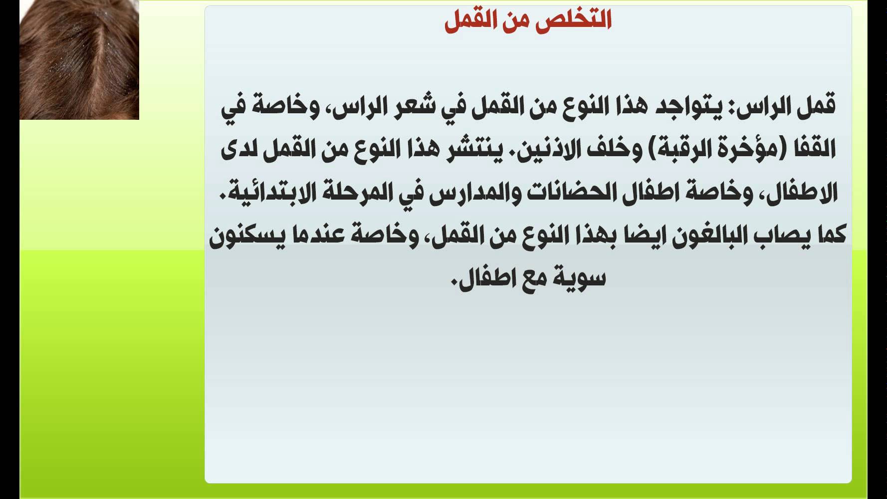 التخلص من القمل - علاج الشعر من القمل و طرق التخلص للابد 1374 1