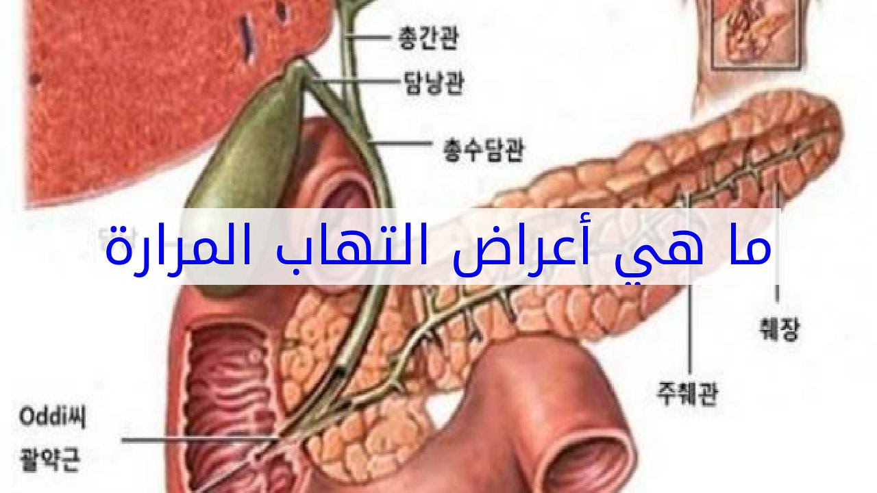 اعراض المرارة , مشكلة اصابه المرارة