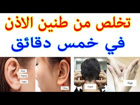 علاج وش الاذن - طنين الاذن وعلاجه الفعال 11739 2