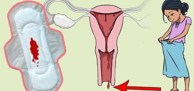الفرق بين دم الدورة ودم الحمل , تعرفي كيف تميزي بين دم الحيض ودم الحمل