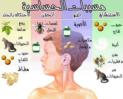 اعراض حساسية الانف , تجنب حساسية الانف