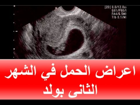 اعراض الحمل بولد , المتابعة اثناء الحمل