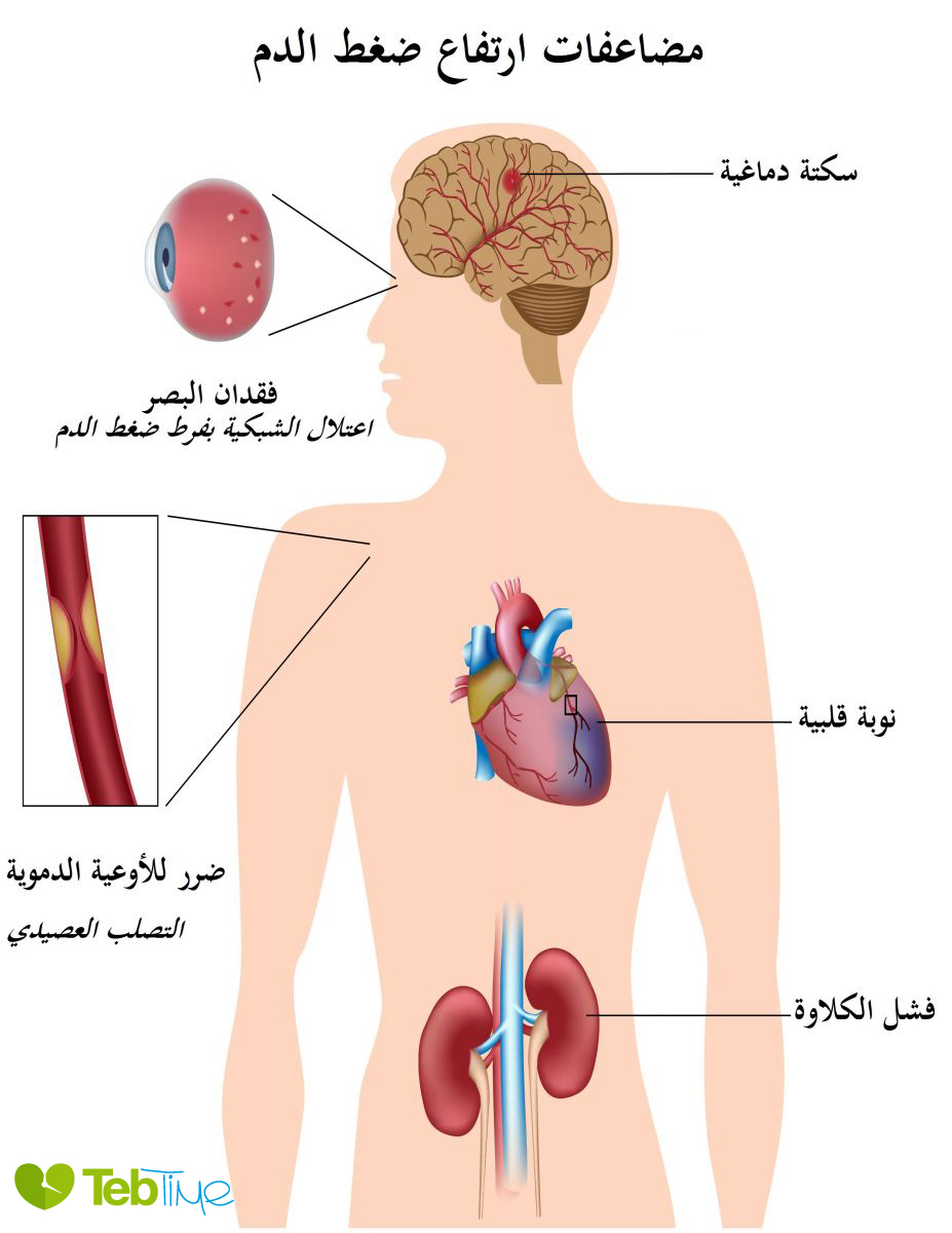 معنى ضغط الدم - معلومات هامة عن ضغط الدم 10973