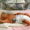 5006 2 اسباب الولادة المبكرة - الاسباب التي تؤدي للولادة المبكرة فاتن سعود