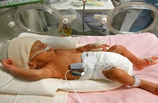 5006 2 اسباب الولادة المبكرة - الاسباب التي تؤدي للولادة المبكرة حبيبه وجدي