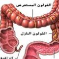 6002 3 مرض القولون - ماهي الاسباب لمرض القاولون فاتن سعود