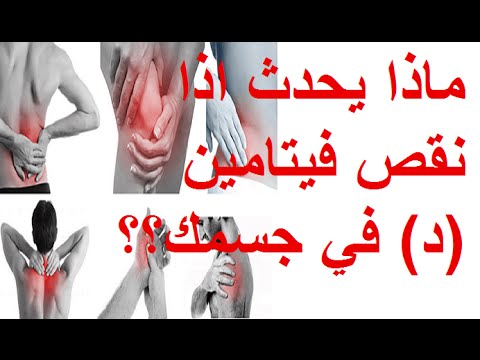11367 1 اعراض نقص فيتامين دال - مخاطر نقص فيتامين دال منى محمد