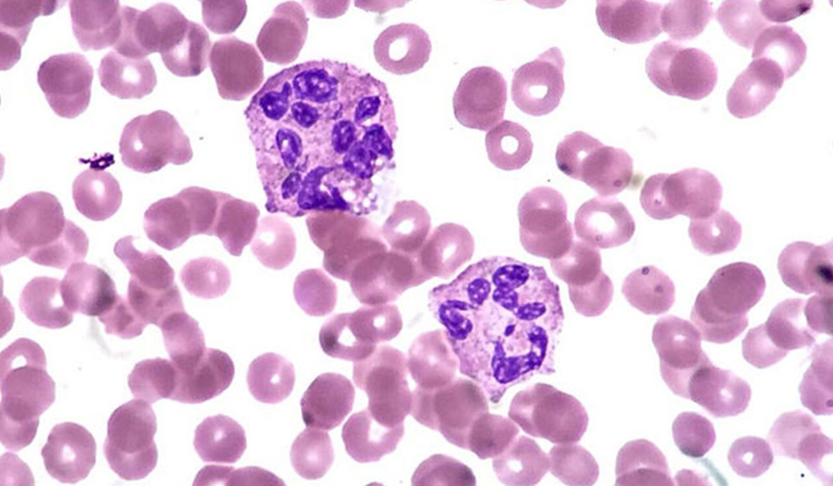 ما هو تحليل neutrophils , ماذا تعرف عن تحليل neutrophils