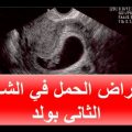 146 3 اعراض الحمل بولد - المتابعة اثناء الحمل منى محمد